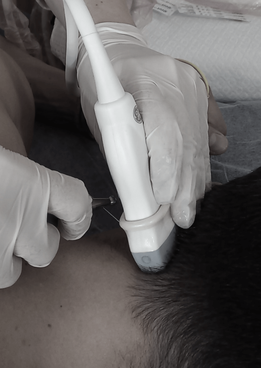 xii-neuroeje-ecografia-y-neuromodulacion